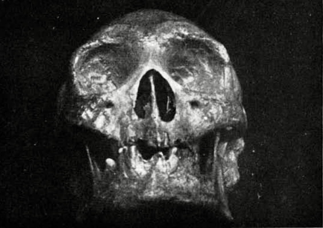 Ellis County Skull