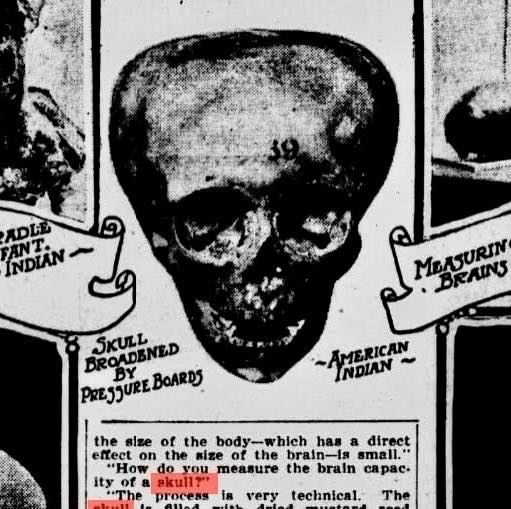 Short broad shaped elongated skulls