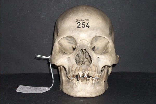 Unearthing Ecuador's Pre-Columbian Dental Bling